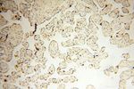 MAGEB18 Antibody in Immunohistochemistry (Paraffin) (IHC (P))