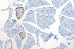 Somatostatin Antibody in Immunohistochemistry (Paraffin) (IHC (P))