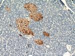 Somatostatin Antibody in Immunohistochemistry (Paraffin) (IHC (P))