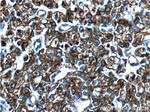 Cytokeratin 8 Antibody in Immunohistochemistry (Paraffin) (IHC (P))