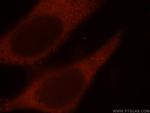 IFT52 Antibody in Immunocytochemistry (ICC/IF)