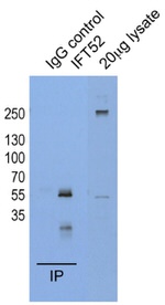 IFT52 Antibody in Immunoprecipitation (IP)