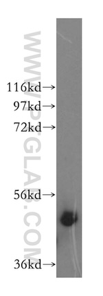 IFT52 Antibody in Western Blot (WB)