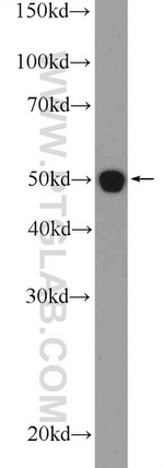 IFT52 Antibody in Western Blot (WB)