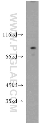 PARP9 Antibody in Western Blot (WB)