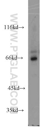 ADCK5 Antibody in Western Blot (WB)