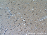 PYK2 Antibody in Immunohistochemistry (Paraffin) (IHC (P))