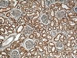 PYK2 Antibody in Immunohistochemistry (Paraffin) (IHC (P))