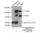 PYK2 Antibody in Immunoprecipitation (IP)