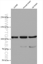 PYK2 Antibody in Western Blot (WB)