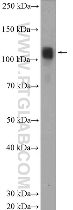 PYK2 Antibody in Western Blot (WB)