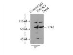 EXOC5 Antibody in Immunoprecipitation (IP)