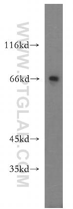 MTMR15 Antibody in Western Blot (WB)