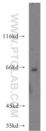 MTMR15 Antibody in Western Blot (WB)