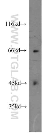 FIGNL1 Antibody in Western Blot (WB)