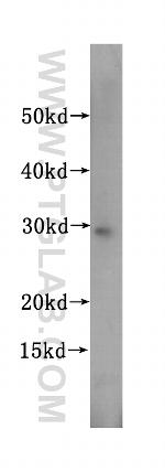 SBDS Antibody in Western Blot (WB)