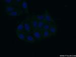 RPL26 Antibody in Immunocytochemistry (ICC/IF)