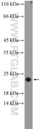 RPL26 Antibody in Western Blot (WB)