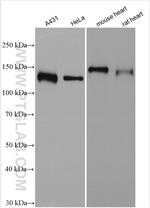 USP28 Antibody in Western Blot (WB)