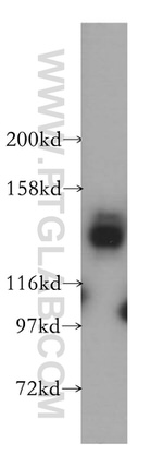 USP28 Antibody in Western Blot (WB)