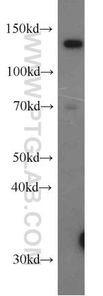 USP28 Antibody in Western Blot (WB)