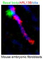 ARL13B Antibody in Immunohistochemistry (IHC)