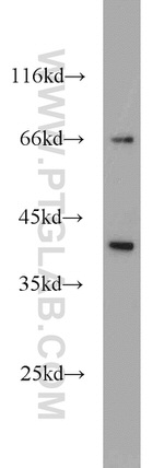 ARL13B Antibody in Western Blot (WB)