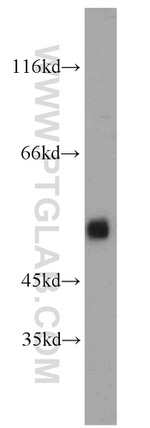 ARL13B Antibody in Western Blot (WB)