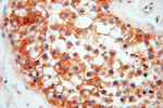 ATP6V1F Antibody in Immunohistochemistry (Paraffin) (IHC (P))