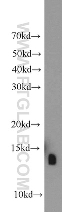 ATP6V1F Antibody in Western Blot (WB)