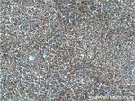 BCL10 Antibody in Immunohistochemistry (Paraffin) (IHC (P))