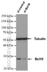 BCL10 Antibody in Western Blot (WB)