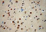 CPSF2 Antibody in Immunohistochemistry (Paraffin) (IHC (P))