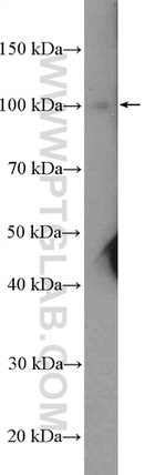 CPSF2 Antibody in Western Blot (WB)