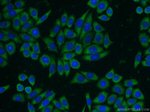RANBP9 Antibody in Immunocytochemistry (ICC/IF)