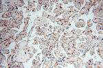 RANBP9 Antibody in Immunohistochemistry (Paraffin) (IHC (P))