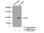 RANBP9 Antibody in Immunoprecipitation (IP)