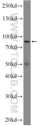 RANBP9 Antibody in Western Blot (WB)