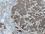 CNDP1 Antibody in Immunohistochemistry (Paraffin) (IHC (P))