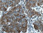 CNDP1 Antibody in Immunohistochemistry (Paraffin) (IHC (P))