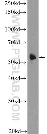 CNDP1 Antibody in Western Blot (WB)