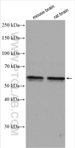 CACNB4 Antibody in Western Blot (WB)