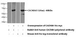 CACNB4 Antibody in Western Blot (WB)