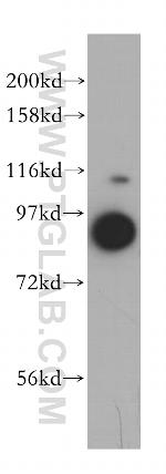 VPS16 Antibody in Western Blot (WB)