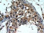 INPP5E Antibody in Immunohistochemistry (Paraffin) (IHC (P))