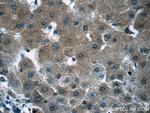 PGK1 Antibody in Immunohistochemistry (Paraffin) (IHC (P))