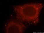 RAB27A Antibody in Immunocytochemistry (ICC/IF)