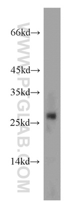 RAB27A Antibody in Western Blot (WB)