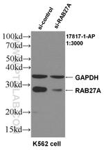 RAB27A Antibody in Western Blot (WB)