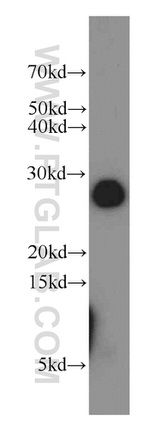 RAB27A Antibody in Western Blot (WB)